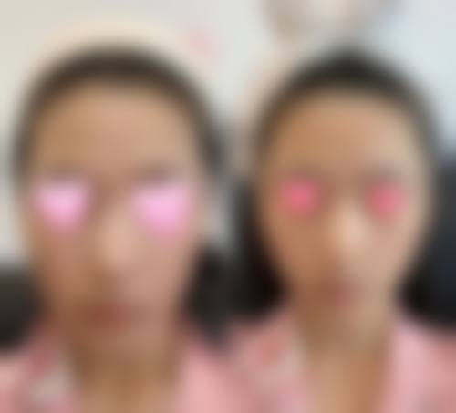 优惠活动详情:限时特别优惠,名额有限