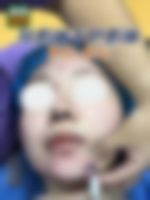 大理纯美医疗整形美容门诊部治疗反馈与口碑评价。