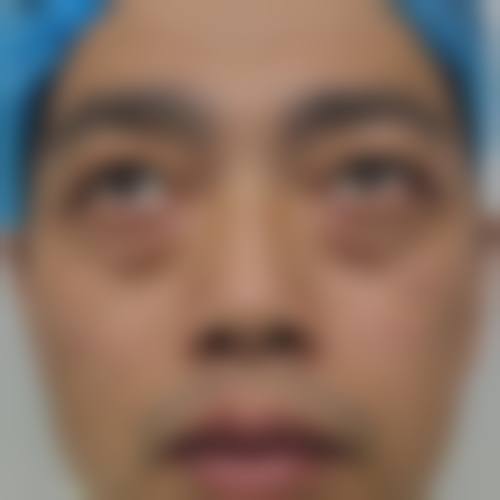 通化市中 心医院手足显微烧伤整形外科治疗反馈与口碑评价。