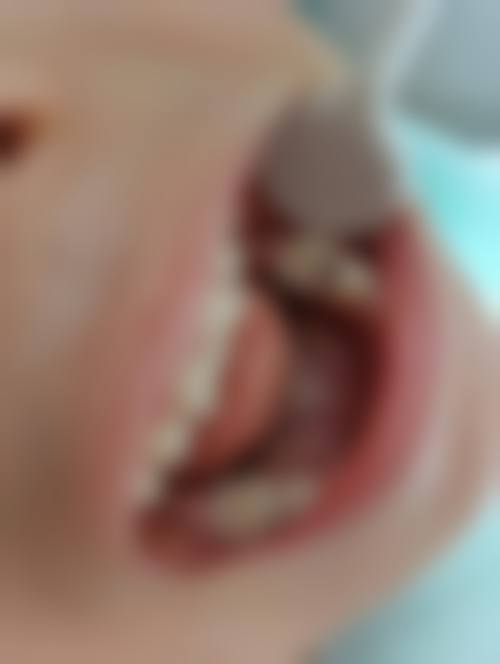 德化县维乐口腔诊所的项目价格