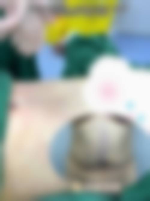 通化市中 心医院手足显微烧伤整形外科预约挂号方式。