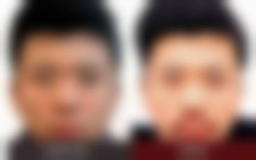 佛山禅城叶玉红整形医院治疗反馈与口碑评价。