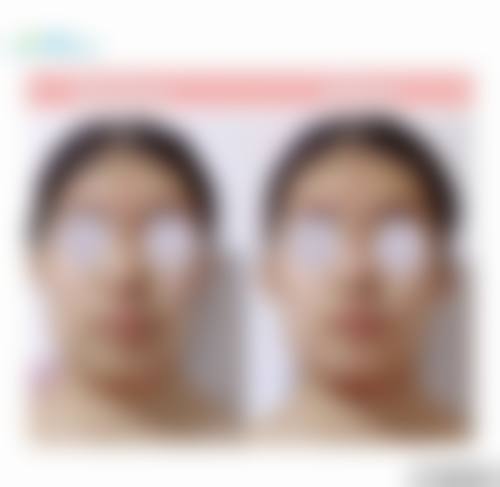 通化市中 心医院手足显微烧伤整形外科擅长项目。
