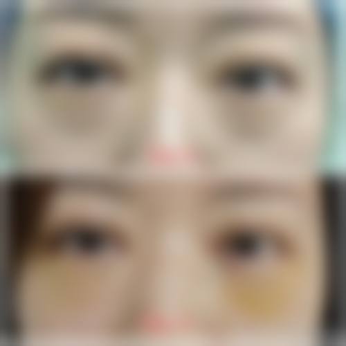 郑州奥美丽亚医疗美容诊所擅长项目。
