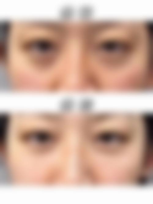 郑州奥美丽亚医疗美容诊所治疗反馈与口碑评价。