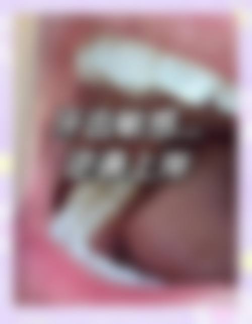 宁波伶齿口腔预约挂号方式。