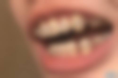 优惠活动详情