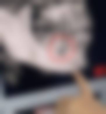 临床实例分享