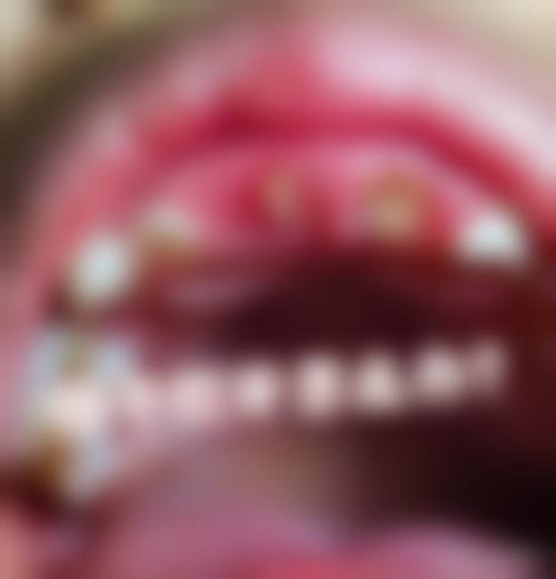 预约优惠活动