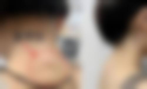 临汾雅美整形美容门诊部门诊营业时间。
