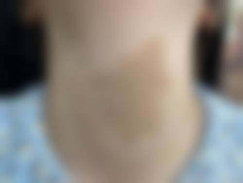 江苏连云港时光盛美美容诊所治疗反馈与口碑评价。