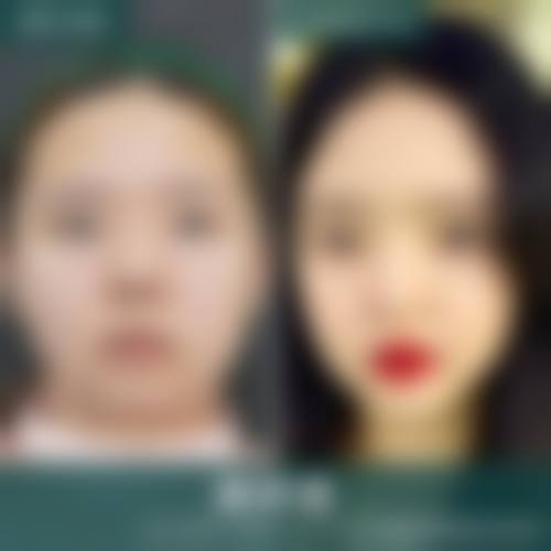 临汾雅美整形美容门诊部预约挂号方式。