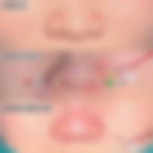 商丘美淇医疗美容诊所项目优势。