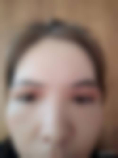 龙岩星森医疗美容门诊部擅长项目。