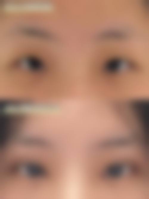 关于肥城市中医院美容科：快问快答