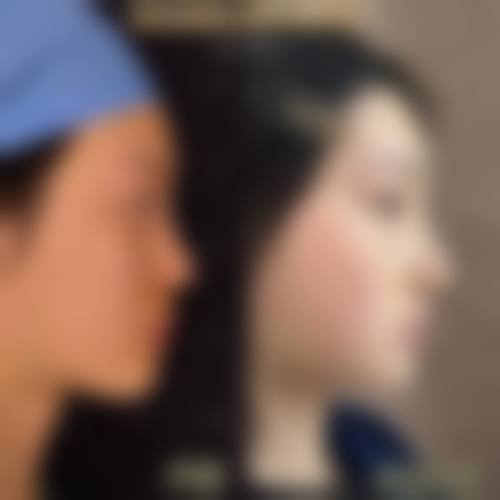南京樱桃私美整形医院预约挂号方式。