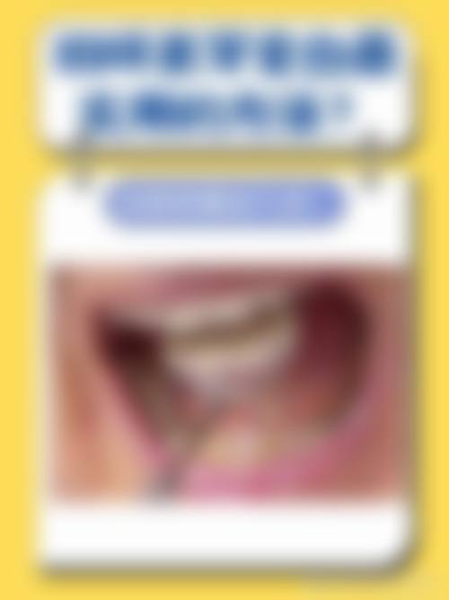 预约优惠活动