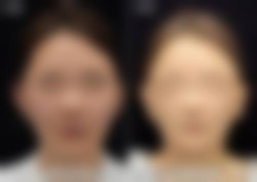 价格透明与优惠活动——高品质也可轻松享有