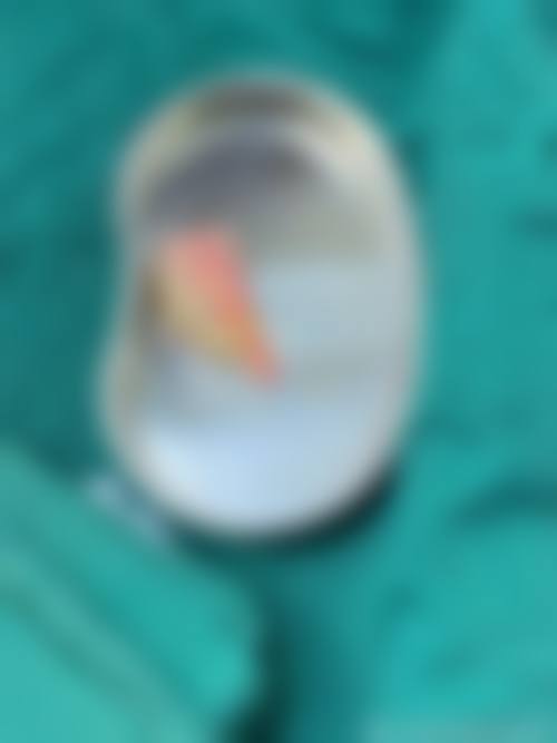 南京樱桃私美整形医院擅长项目。
