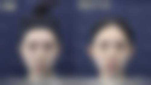 优惠活动详情，即刻享受超值变得更美方案