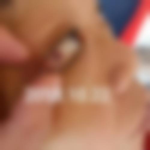南宁市第八人民医院眼科医生团队经验稳定。