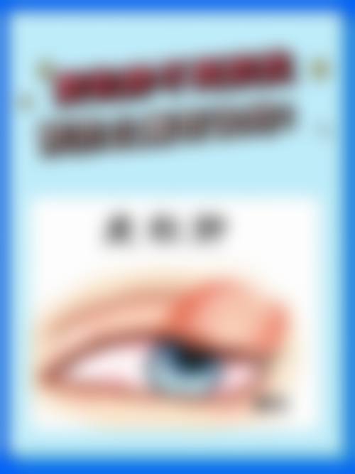 梧州市工人医院眼科擅长项目。