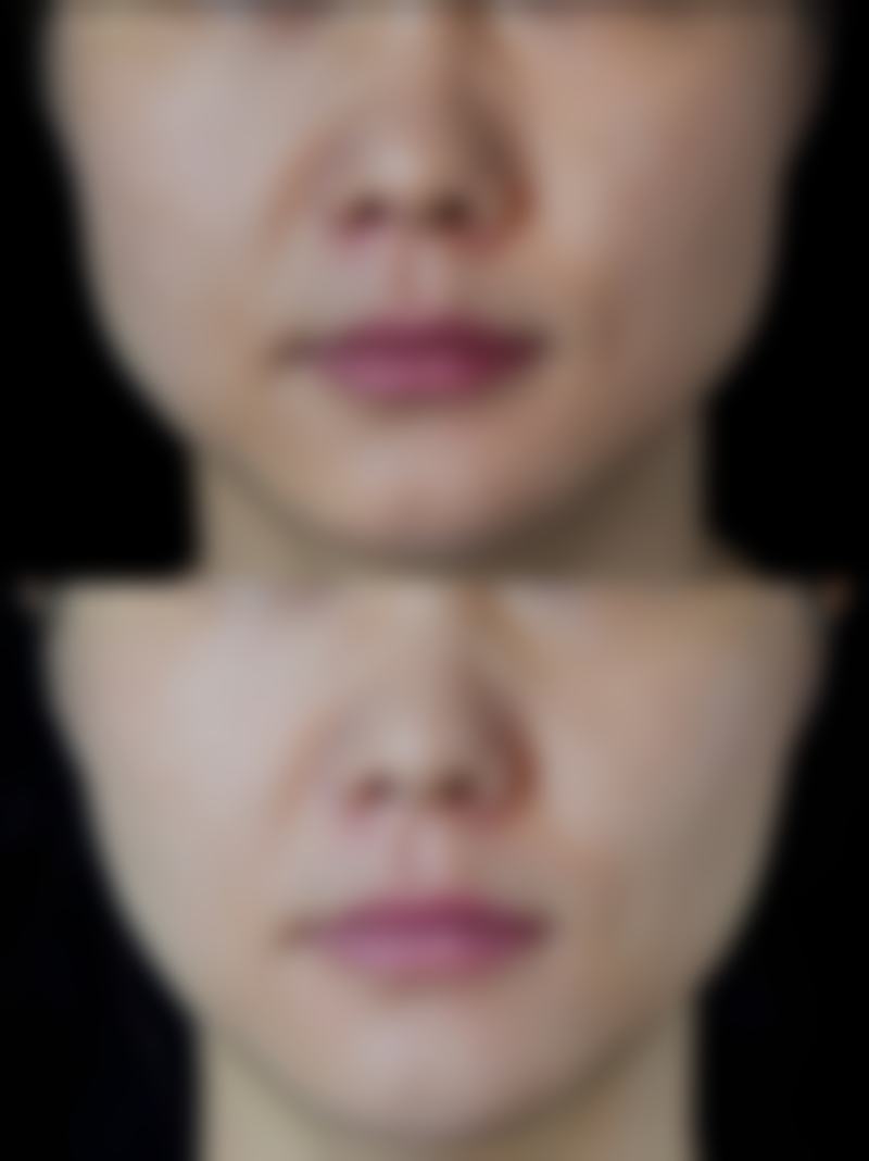 正规资质保护，安心美丽有据可依