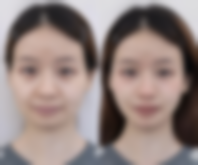 本溪极美医疗美容诊所的预约挂号方式